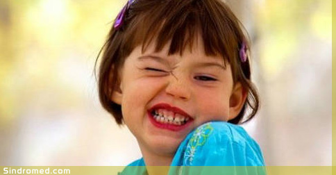 Sindrome de tourette