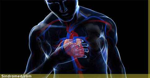 Sindrome brugada